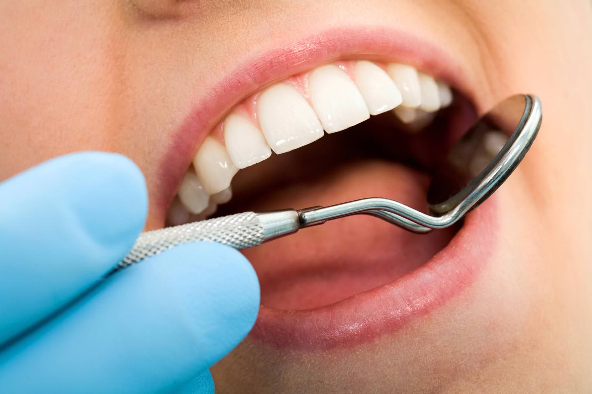 dental exam